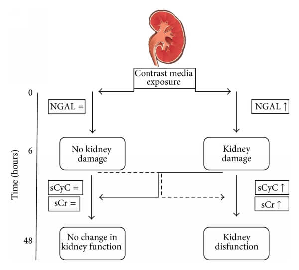 CysC與NGAL、Cr的關(guān)系